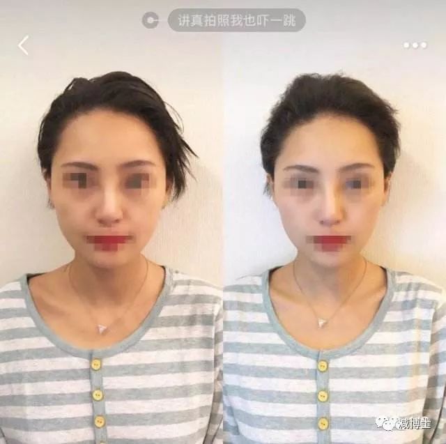 脸好大如何瘦脸,脸好大怎么恢复