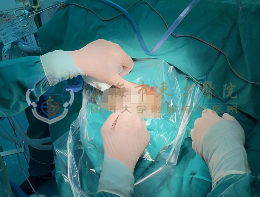 家有患精神分裂症的老人该怎么办,家有精神病人不肯吃药怎么办