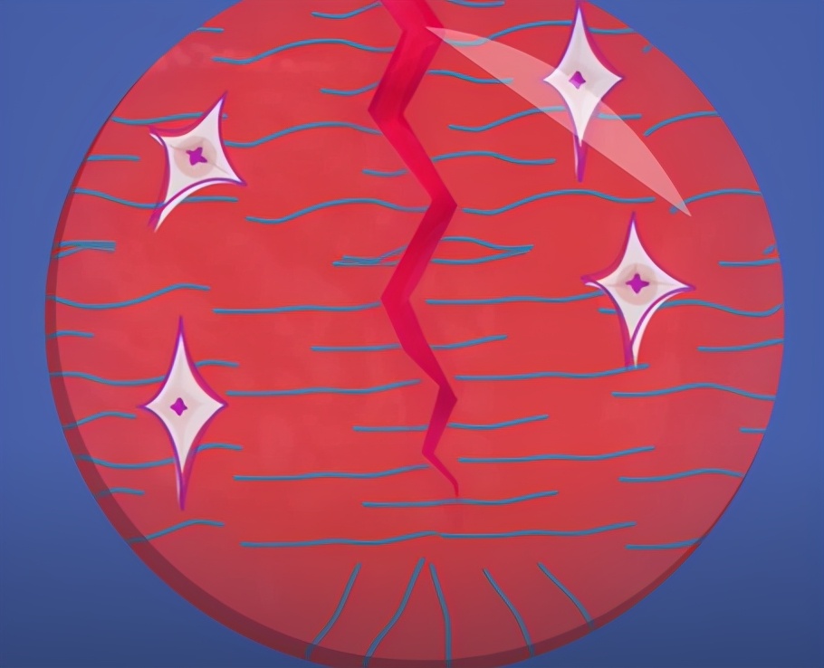 受伤的伤疤愈合后为什么还痛,好了伤疤忘了疼为什么