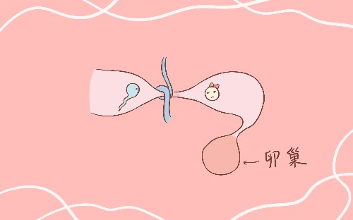 国外女人都是怎么避孕的,当代夫妻都怎么避孕