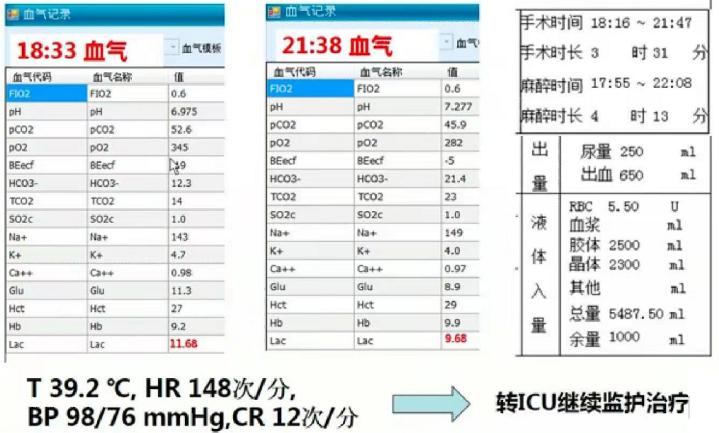 一例感染性休克患者的麻醉处理