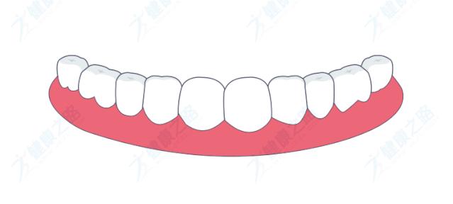 缺牙前后牙都蛀牙了需要怎么补,牙齿牙龈萎缩不整齐有蛀牙有缺牙