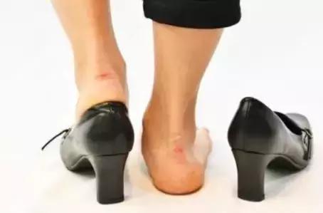 鞋子买小了挤脚妙招,鞋子买小了前面挤脚怎么办