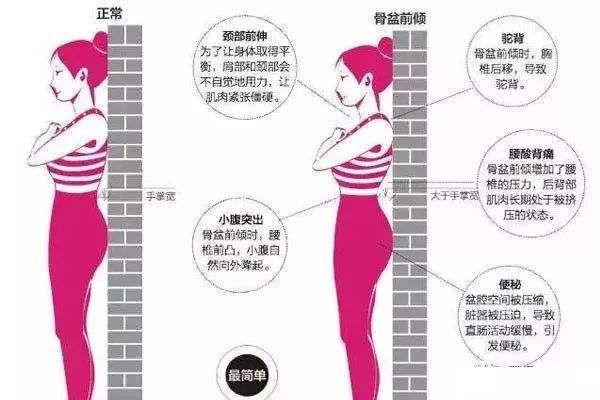 你渴望的“前凸后翘”很可能会毁了你真正的美感，痛不堪言