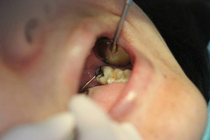 牙科诊所里你不知道的事,口腔医生提醒