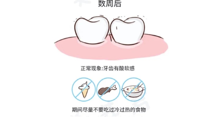 洗牙真的不好么牙医告诉你真相,一个牙医的良心忠告洗牙的利与弊