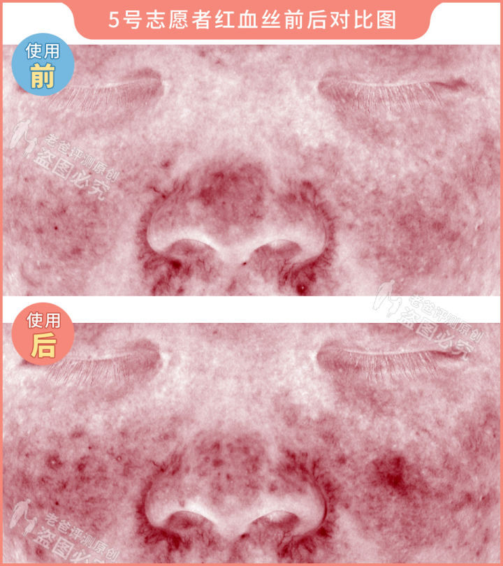 300块的网红美容仪有效果吗,网红家用美容仪测评