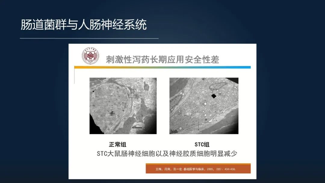 一招调理肠道改善便秘,肠道水疗治便秘有效吗