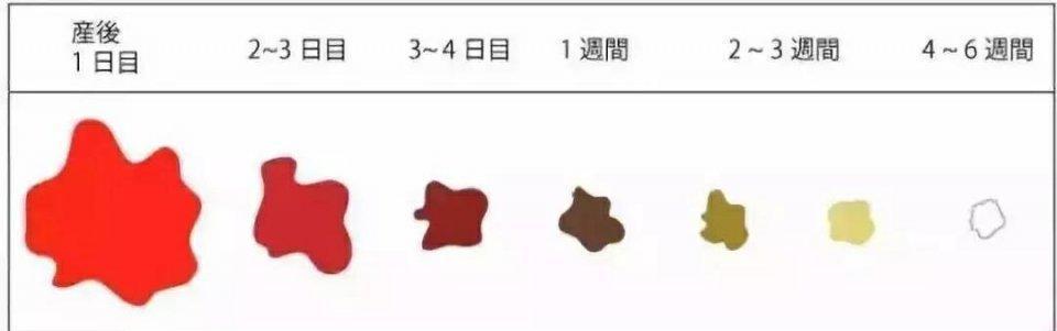 不管顺产还是剖腹产孩子健康,专家说剖腹产坐月子谨记10件事