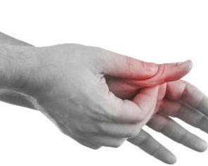 非布司他治痛风效果如何,非布司他治疗痛风有效吗