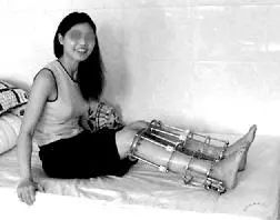 私密整容紧缩手术在中国合法吗,整容医院做私密收紧术要住院吗