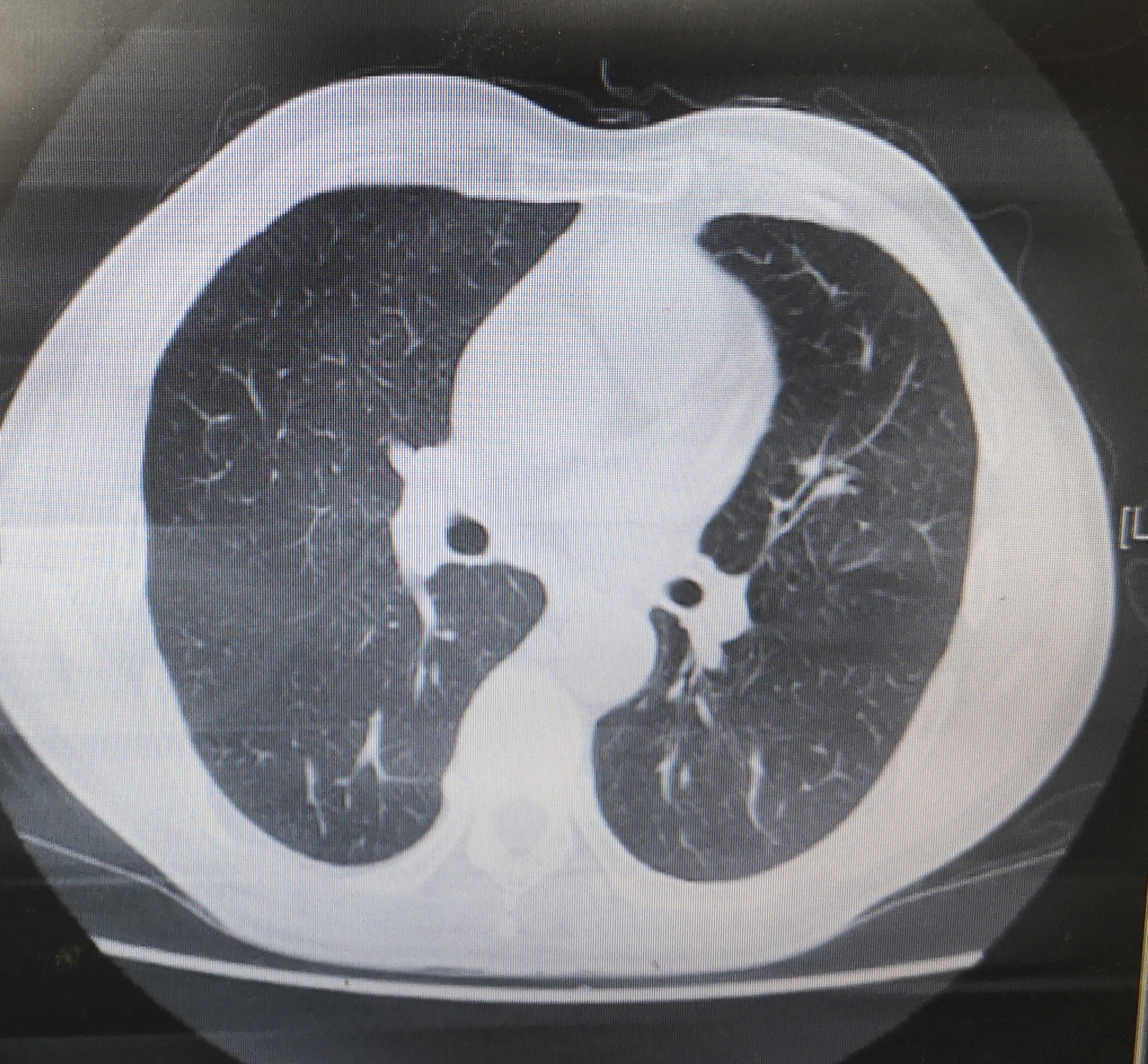 用大气管给气球充气危险吗,气球充太饱会爆破吗