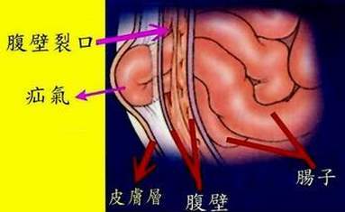 儿童出现针尖样小疙瘩是什么病,宝宝有小疙瘩一定要吃药吗
