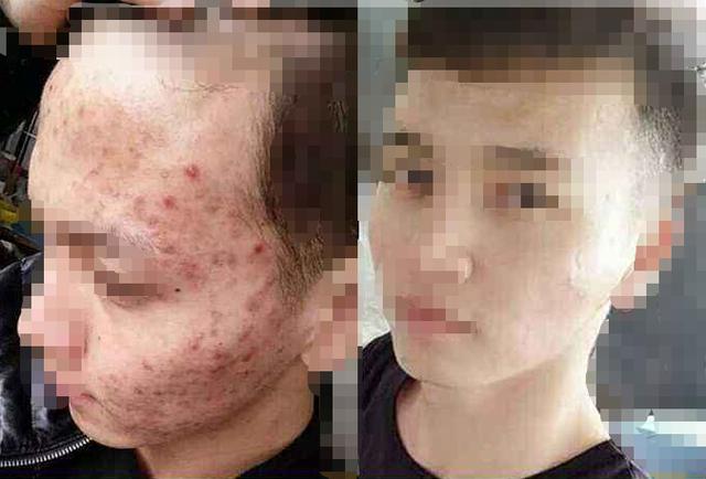 面部控油的最有效方法,出油控油洗面奶