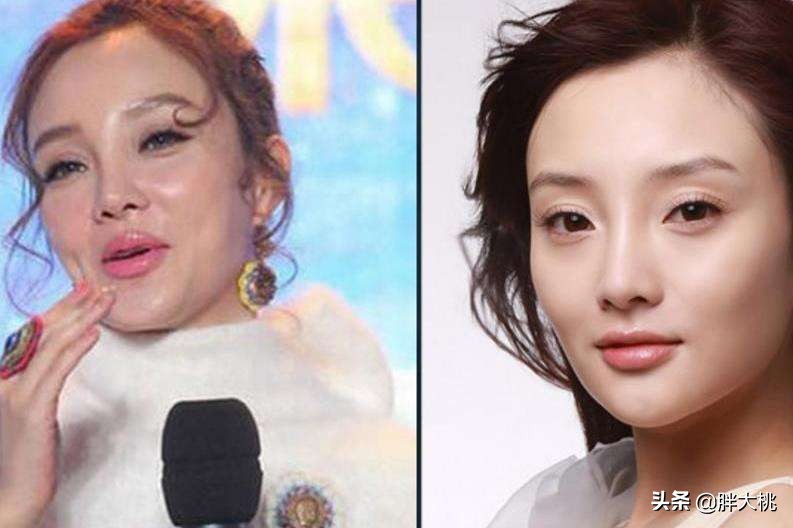 透明质酸和玻尿酸有什么区别,透明质酸跟玻尿酸是一个东西吗