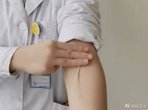 抽血拿针的正确姿势图解,抽血手握拳的正确手法