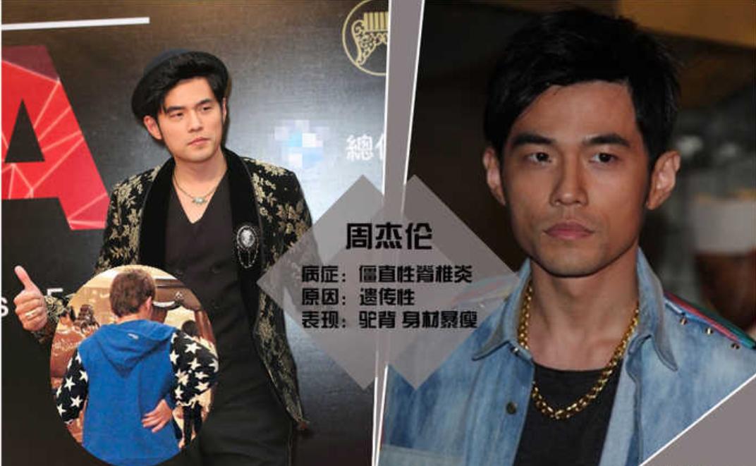 有钱也治不好病的10位明星,有钱也治不好病的四位明星