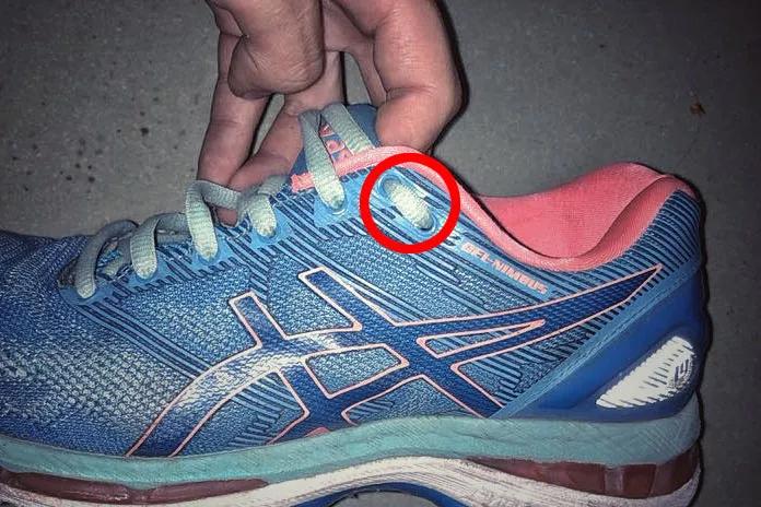 跑步后脚趾甲充血变黑怎么办,跑步为什么有黑指甲