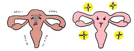 恶露少说明子宫恢复不好吗,子宫恢复检查