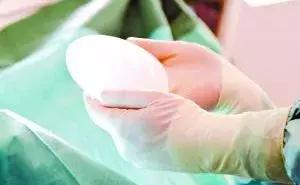 乳房肿块和纤维腺瘤,乳腺纤维腺瘤肿块有无血流信号