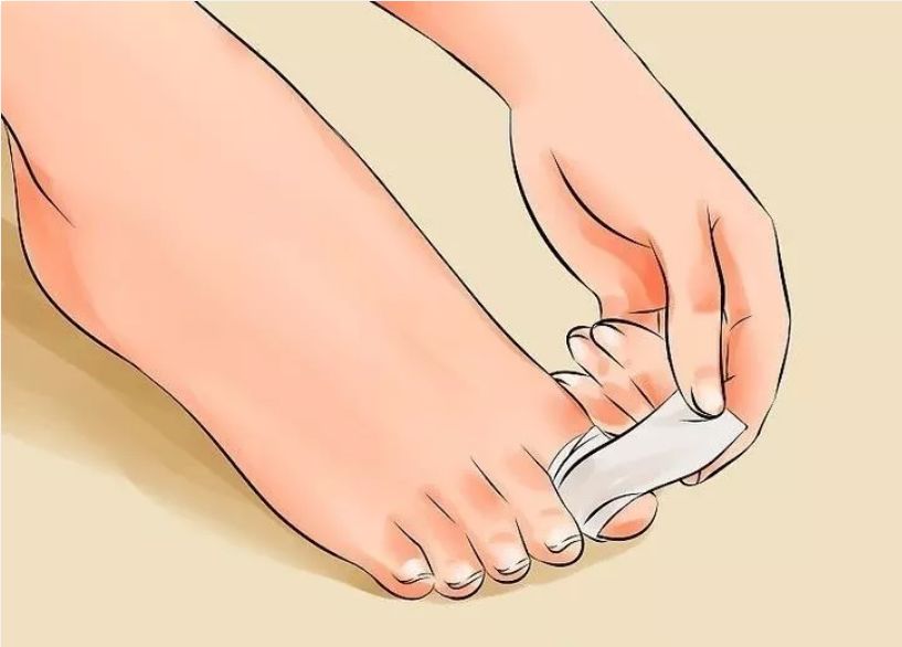 宝宝脚趾甲往肉里长怎么剪,宝宝脚趾甲长到肉里怎么办