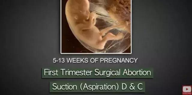 丁嘉丽明星的故事,丁嘉丽央视