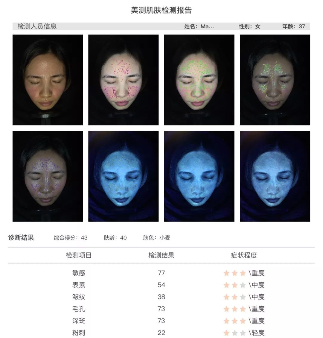 小茂肌诊室∣美容仪挑战：家用美容仪到底值得投资吗？