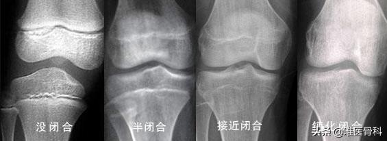 孩子出现发育异常，医生告诉你：可能是这几种原因导致