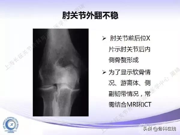 肘关节镜手术后引流,肘关节镜微创手术