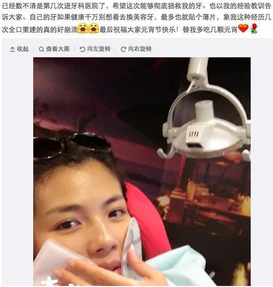 刘涛全瓷牙经验之谈,为什么刘涛说不要轻易做全瓷牙