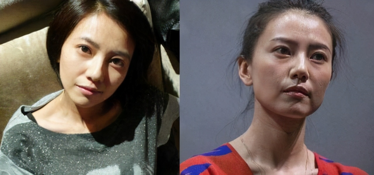 法令纹显老是什么原因,你比同龄人看起来老的原因是什么