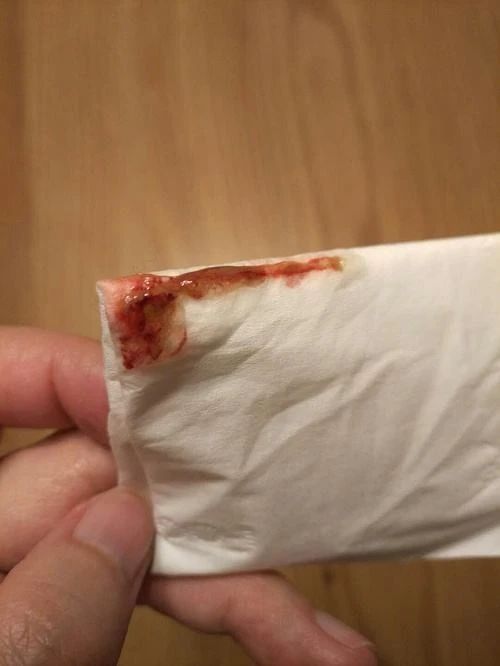 三个月的幼猫拉屎带血是怎么回事,猫拉屎带血要怎么才能解决