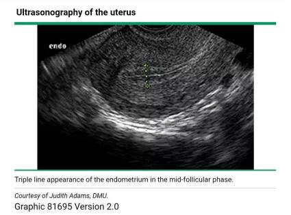 子宫壁薄医生不建议怀孕怎么办,子宫内膜薄可以怀疑吗