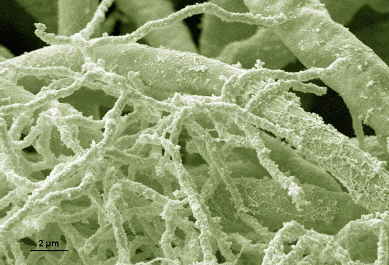 火鹰心脏支架怎么样,火鹰支架是第几代