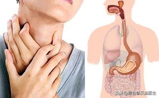 呕吐后食道有异物感吞咽疼痛,偶尔有呕吐感是什么原因