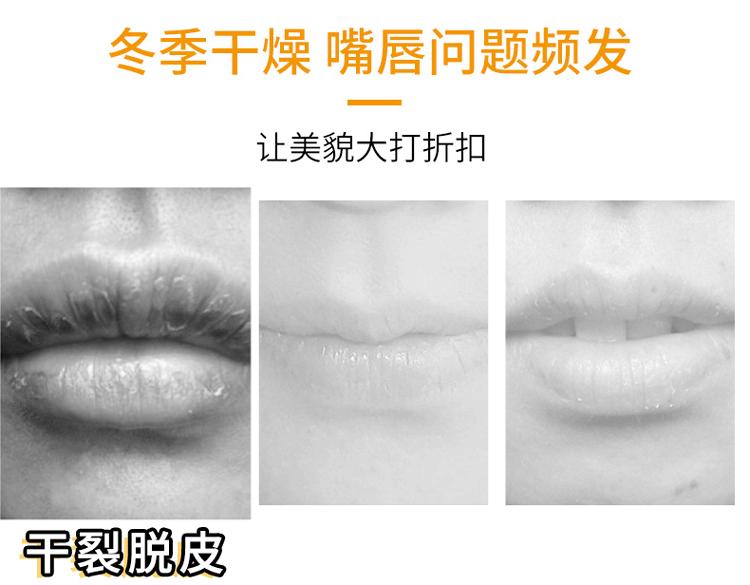 泫雅玻尿酸唇,泫雅水光唇