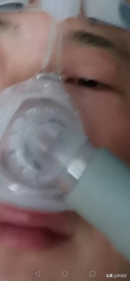 打呼噜呼吸机使用方法视频,呼吸机治疗打呼噜真实感受