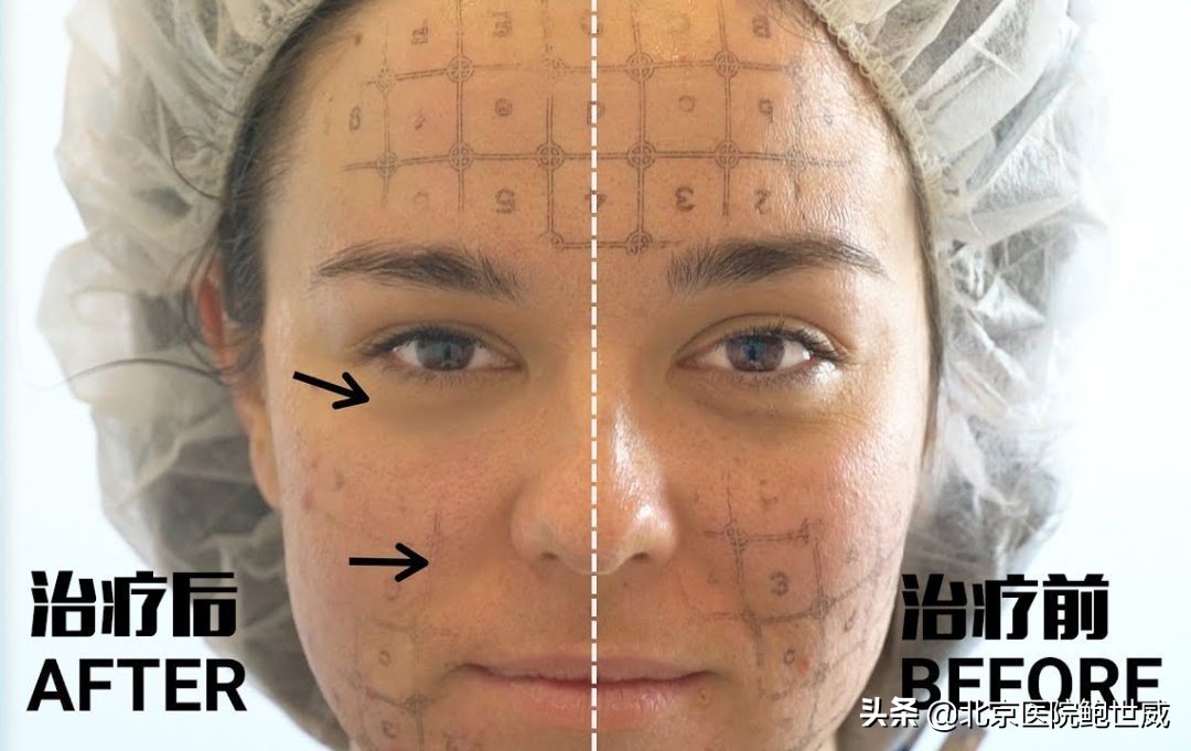 了解抗衰老护肤品,热玛吉抗衰2019