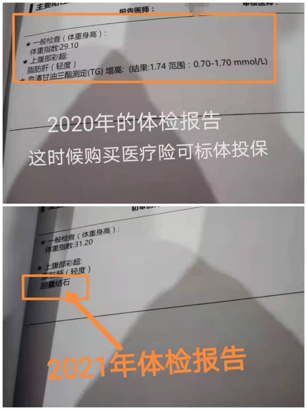 买保险的正确方法视频,买保险要告知事项