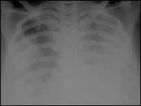 陈荣昌在哪个医院,陈荣昌广州呼吸疾病研究所所长