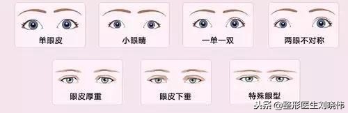 眼睛手术的坑,不要往里面跳了