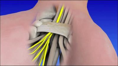 常见麻木病因和治疗方法,手部麻木的7种常见病因