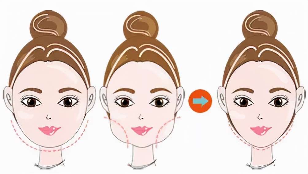 打了瘦脸针多久效果完全显现出来,打瘦脸针视频全过程