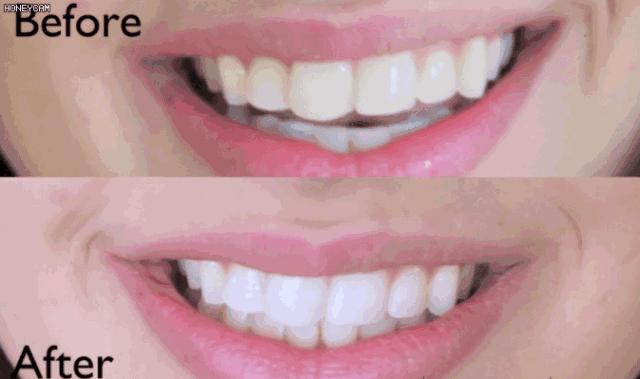 刷牙时一个小窍门彻底告别黄臭牙,刷牙的时候放点小苏打牙会变白吗