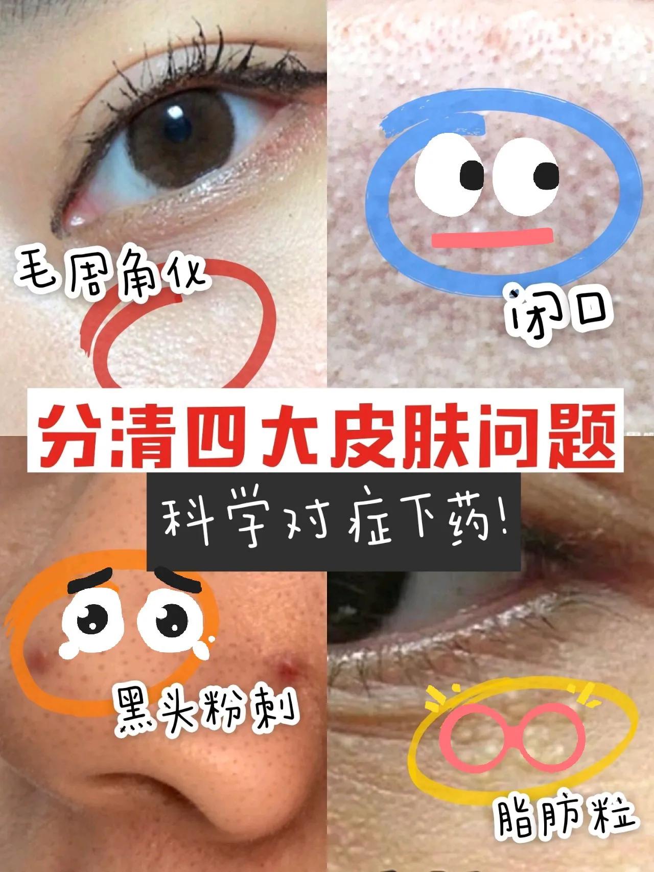 如何才能知道自己脸上长的是什么,怎么才能自己判断脸上长的是什么