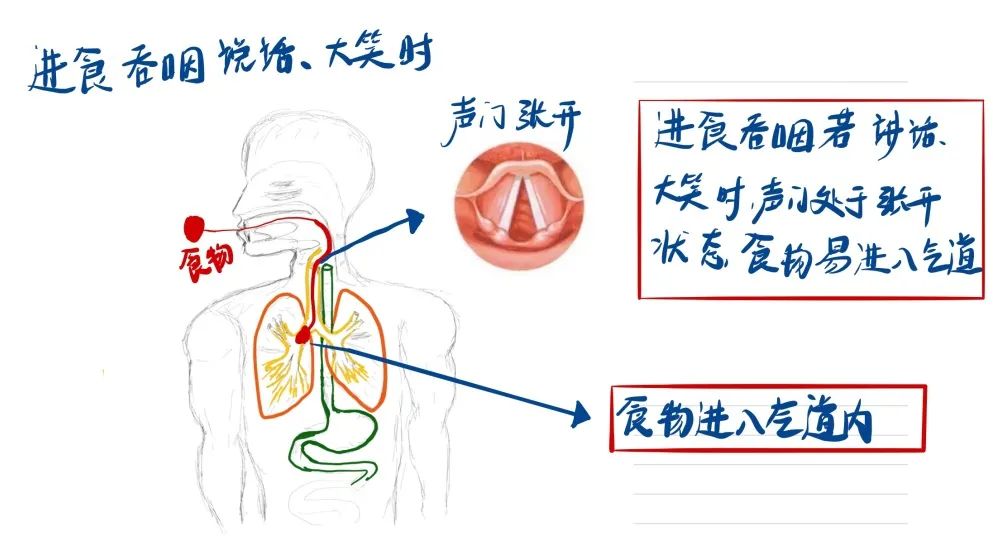 肺炎治不好会怎么样,肺炎治不好怎么办