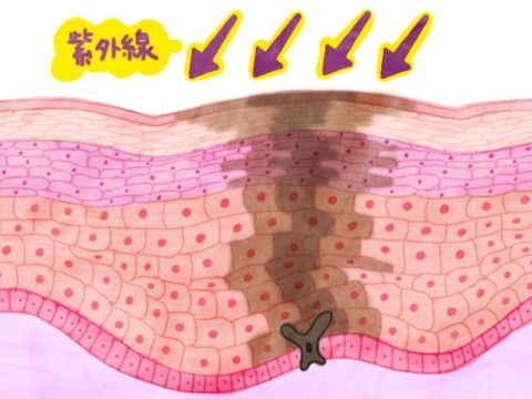 变白变美一白遮百丑,一白遮百丑怎么美白