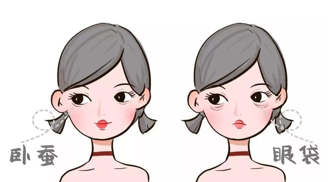 如何分清楚卧蚕泪沟眼袋黑眼圈,眼袋卧蚕和泪沟有什么区别
