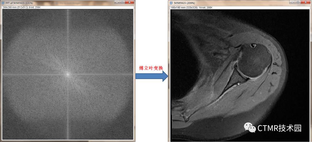 磁共振成像的基本原理和优缺点,为什么磁共振成像要很久