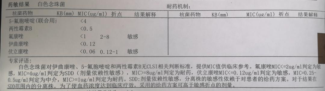 小腹痛、白带脓性,先看看这个检查